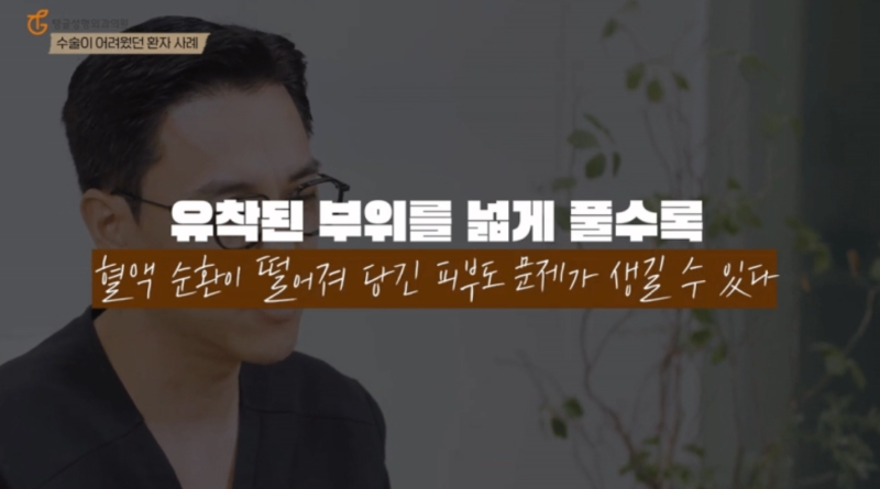 Liposuction Methods: Regret if You Don't Know Them 사진 2