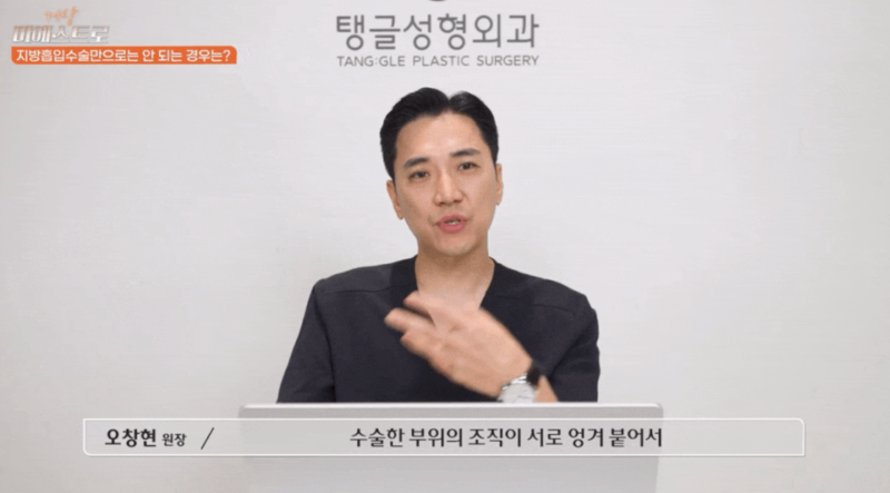 3 Things to Check Before Abdominal Liposuction 사진 3