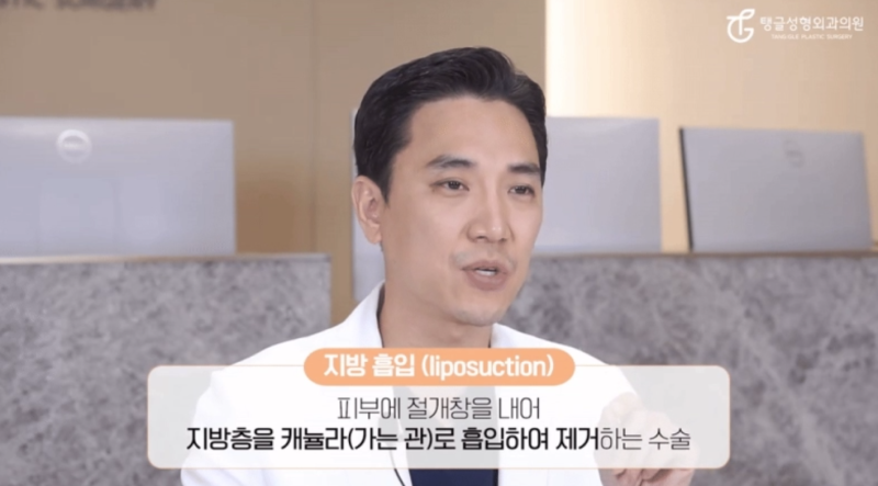 Why Abdominal Liposuction May Require a Lift 사진 3