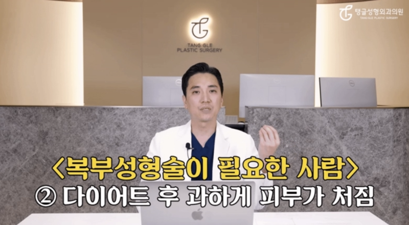 Why Abdominal Liposuction May Require a Lift 사진 4