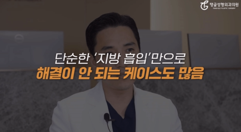 Why Abdominal Liposuction May Require a Lift 사진 2