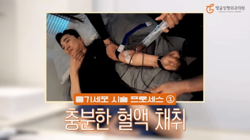 Can Stem Cell Intravenous Injections Treat Skin Aging?