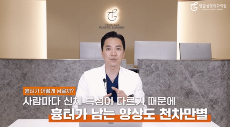 Arm Lift: Is It for Everyone? 사진 3