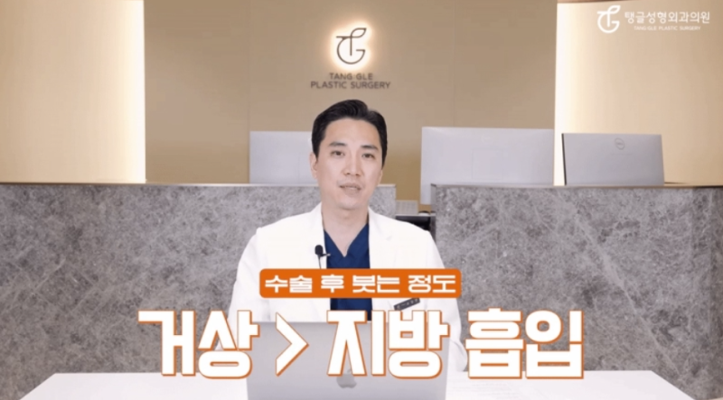 Arm Lift: Is It for Everyone? 사진 4