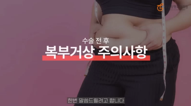 Abdominoplasty: Post-Surgery Care and Precautions