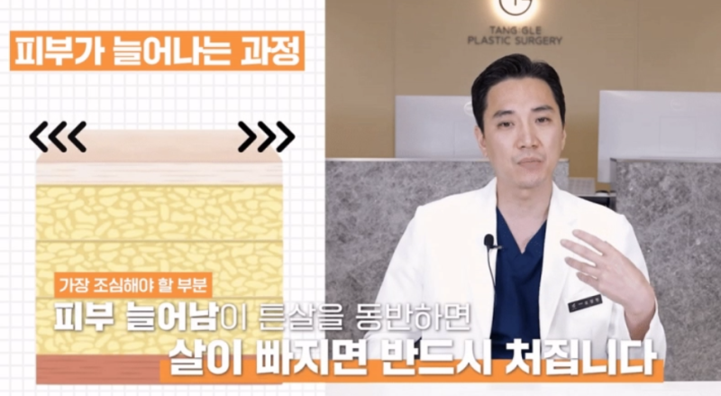 Skin Sagging Surgery: Did You Lose Weight Too Quickly? 사진 2