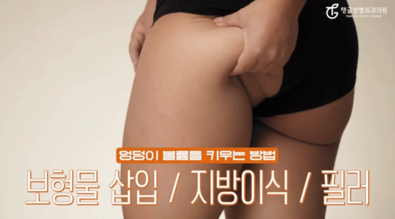 Do You Know About Buttock Augmentation and Buttock Lift Surgery? 사진 2