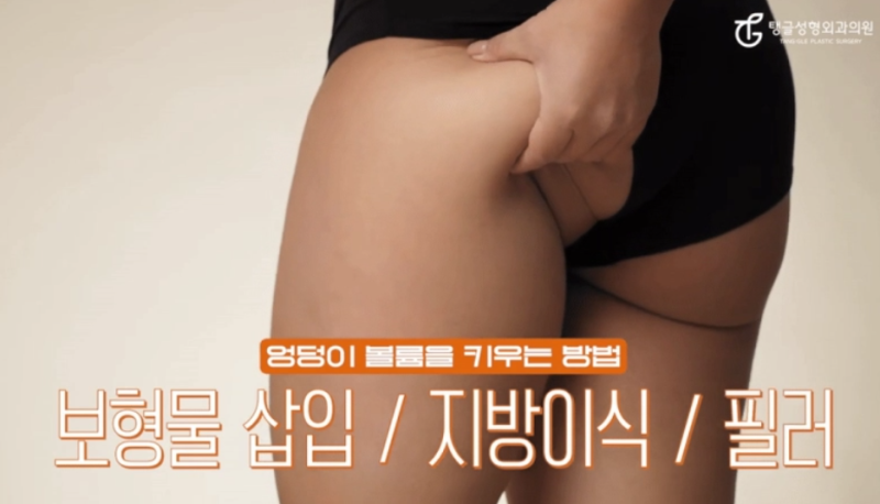 Do You Know About Buttock Augmentation and Buttock Lift Surgery? 사진 2