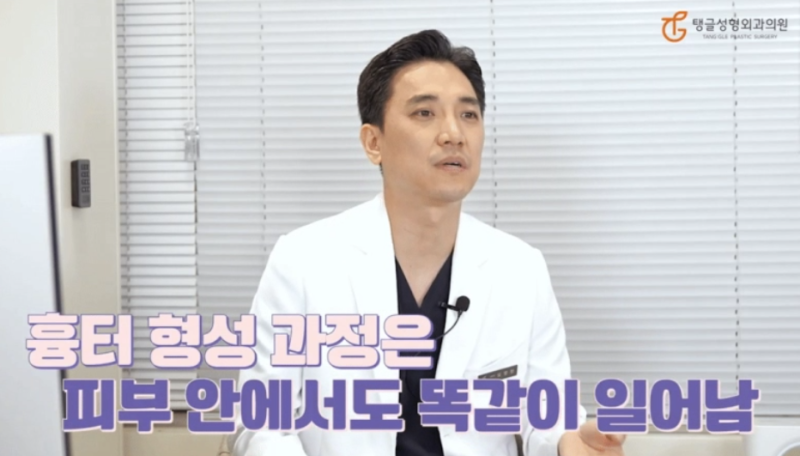 Abdominoplasty: Liposuction Alone Isn't Enough 사진 3