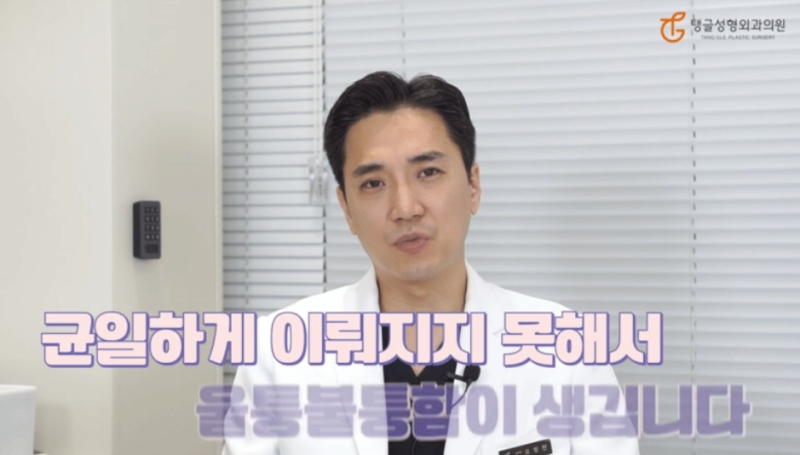 Abdominoplasty: Liposuction Alone Isn't Enough 사진 2