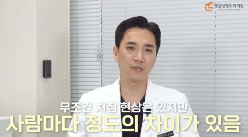 Thigh Liposuction Side Effects: Know Before You Decide! 사진 2