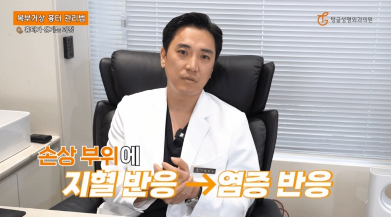 Abdominoplasty: Scar Management Methods Explained