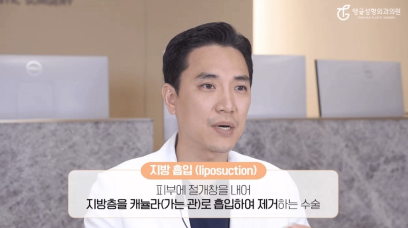 Liposuction Methods: Do They Really Work?