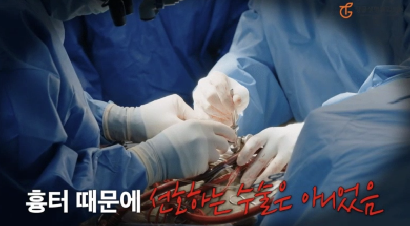 Abdominoplasty: Worried About Side Effects?