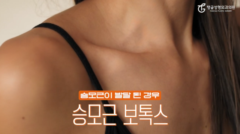 Harga Botox Trapezius, Jika Leher Terlihat Pendek