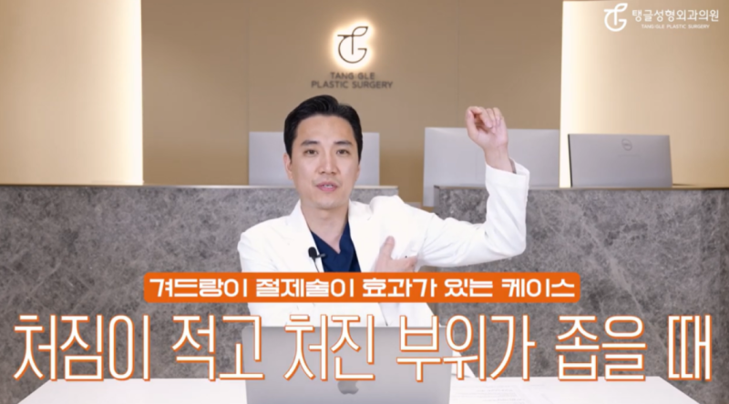 Arm Liposuction: Is It Really Necessary?