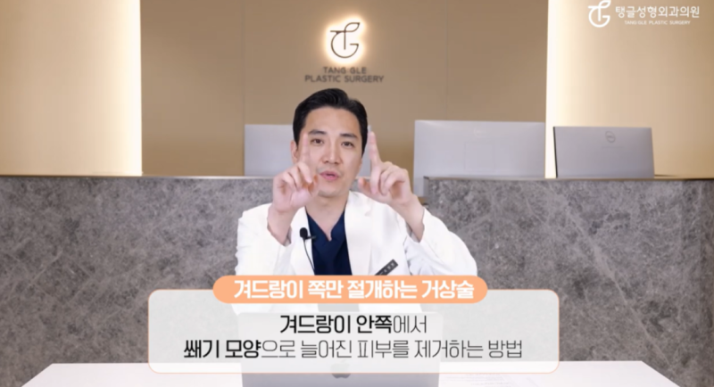 Arm Liposuction: Is It Really Necessary? 사진 2