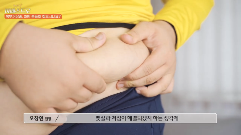 Abdominoplasty: What You Should Know If You're Considering It 사진 5