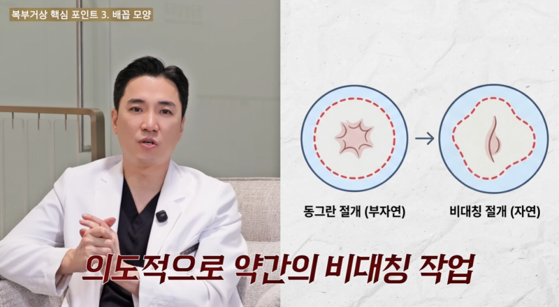 3 Key Points for Tummy Tuck: What You Must Know Before Surgery 사진 5