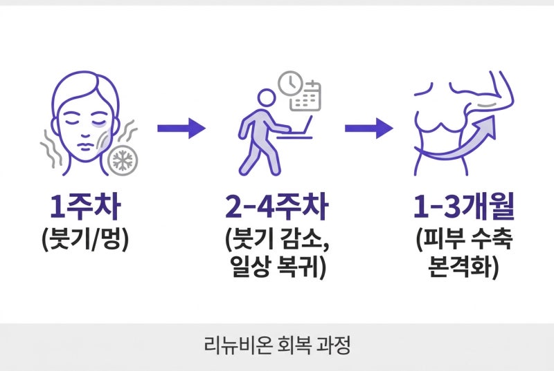 Curious about Abdominal Tightening Renuvion? From Effects to Recovery! 사진 6