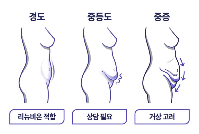 Curious about Abdominal Tightening Renuvion? From Effects to Recovery! 사진 3