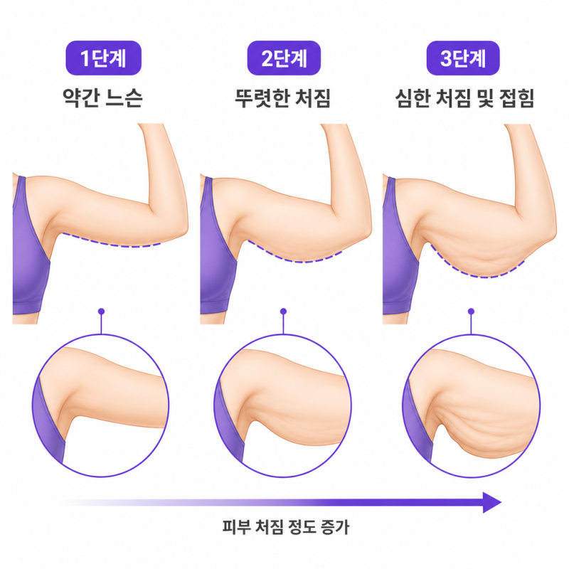 체중 감량 후 팔거상 | 지금 당장 알아야 할 핵심 정보