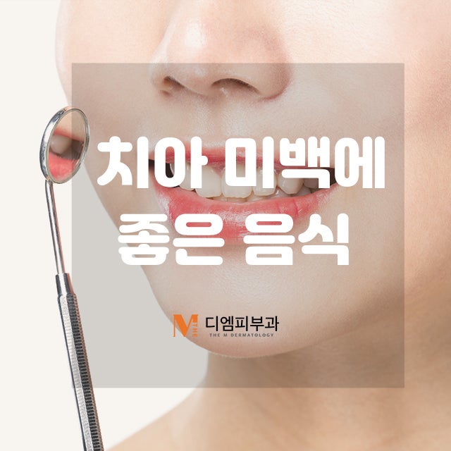 치아미백에좋은음식으로 깨끗한 미소 만들기!