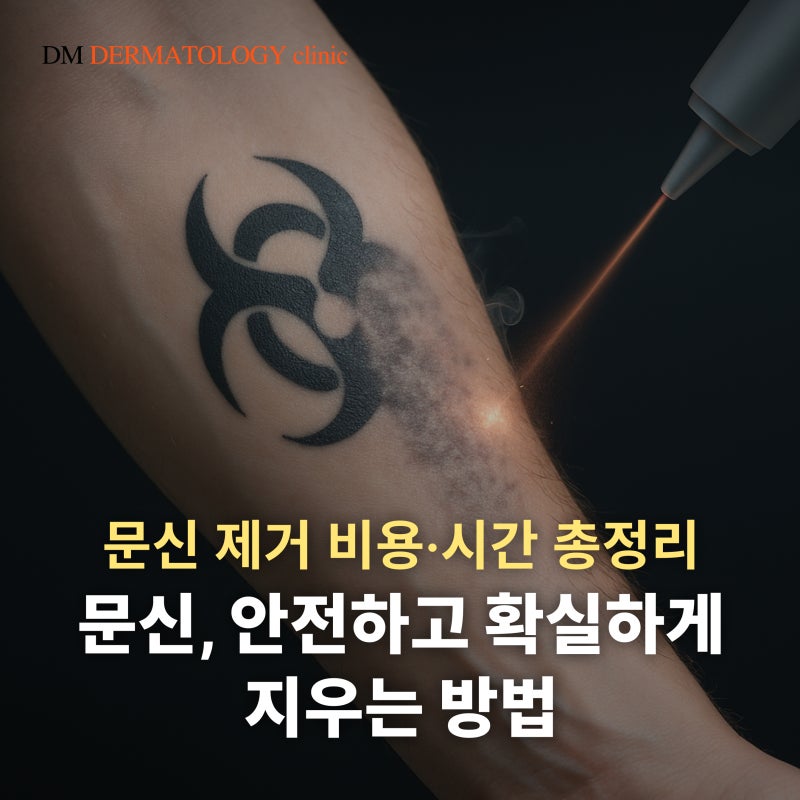 문신 제거 비용, 시간 총정리! 타투 지우기 전 꼭 알아야 할 3가지 핵심 포인트