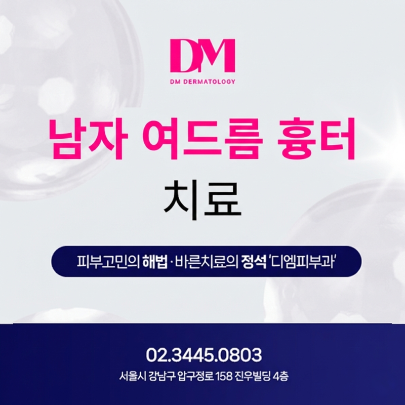 남자 여드름 흉터 치료 피부과에서 하는 방법은