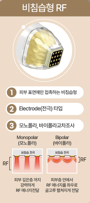 홍대피부과, 포텐자 진짜 효과 있을까? 의사가 답변해 드립니다. 사진 6