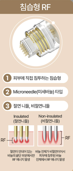 홍대피부과, 포텐자 진짜 효과 있을까? 의사가 답변해 드립니다. 사진 4